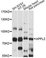 APPL2 Antibody - Western blot analysis of extracts of various cell lines, using APPL2 antibody at 1:1000 dilution. The secondary antibody used was an HRP Goat Anti-Rabbit IgG (H+L) at 1:10000 dilution. Lysates were loaded 25ug per lane and 3% nonfat dry milk in TBST was used for blocking. An ECL Kit was used for detection and the exposure time was 90s.