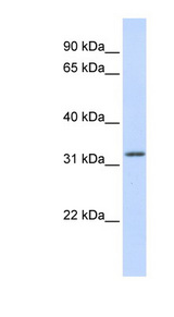 Aprataxin / APTX Antibody - APTX / Aprataxin antibody Western blot of Fetal Muscle lysate. This image was taken for the unconjugated form of this product. Other forms have not been tested.