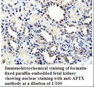 Aprataxin / APTX Antibody