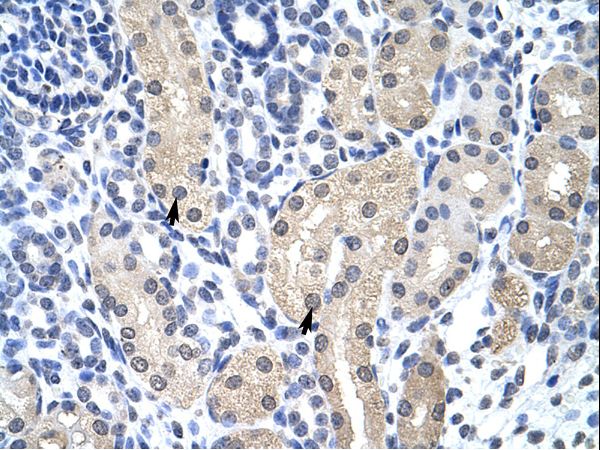 Aprataxin / APTX Antibody - APTX / Aprataxin antibody ARP40014_T100-NP_778243-APTX (aprataxin) Antibody was used in IHC to stain formalin-fixed, paraffin-embedded human kidney.  This image was taken for the unconjugated form of this product. Other forms have not been tested.