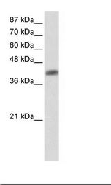Aprataxin / APTX Antibody - NCI-H226 Cell Lysate.  This image was taken for the unconjugated form of this product. Other forms have not been tested.