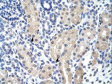 Aprataxin / APTX Antibody - APTX / Aprataxin antibody ARP40014_T100-NP_778243-APTX (aprataxin) Antibody was used in IHC to stain formalin-fixed, paraffin-embedded human kidney.  This image was taken for the unconjugated form of this product. Other forms have not been tested.