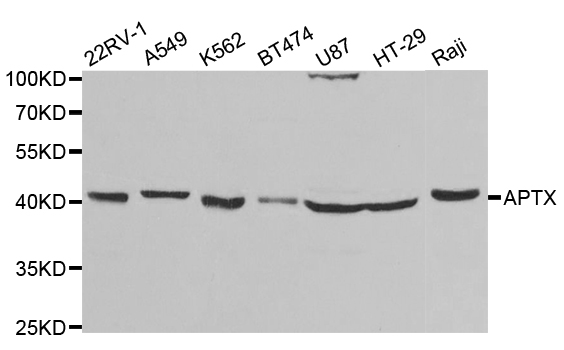 Aprataxin / APTX Antibody - Western blot analysis of extracts of various cell lines.