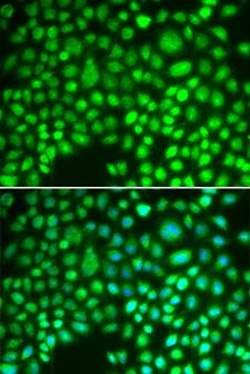 Aprataxin / APTX Antibody - Immunofluorescence analysis of HeLa cells.