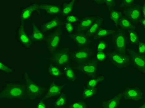Aprataxin / APTX Antibody - Immunofluorescence analysis of A549 cells.