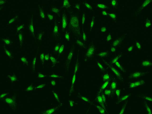 Aprataxin / APTX Antibody - Immunofluorescence staining of APTX in PC3 cells. Cells were fixed with 4% PFA, permeabilzed with 0.1% Triton X-100 in PBS, blocked with 10% serum, and incubated with rabbit anti-Human APTX polyclonal antibody (dilution ratio 1:200) at 4°C overnight. Then cells were stained with the Alexa Fluor 488-conjugated Goat Anti-rabbit IgG secondary antibody (green). Positive staining was localized to Nucleus.