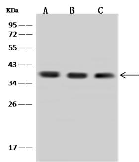 Aprataxin / APTX Antibody - Anti-APTX rabbit polyclonal antibody at 1:500 dilution. Lane A: HeLa Whole Cell Lysate. Lane B: A549 Whole Cell Lysate. Lane C: 293 Whole Cell Lysate. Lysates/proteins at 30 ug per lane. Secondary: Goat Anti-Rabbit IgG (H+L)/HRP at 1/10000 dilution. Developed using the ECL technique. Performed under reducing conditions. Predicted band size: 40 kDa. Observed band size: 40 kDa.