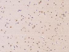Aprataxin / APTX Antibody - Immunochemical staining of human APTX in human brain with rabbit polyclonal antibody at 1:100 dilution, formalin-fixed paraffin embedded sections.