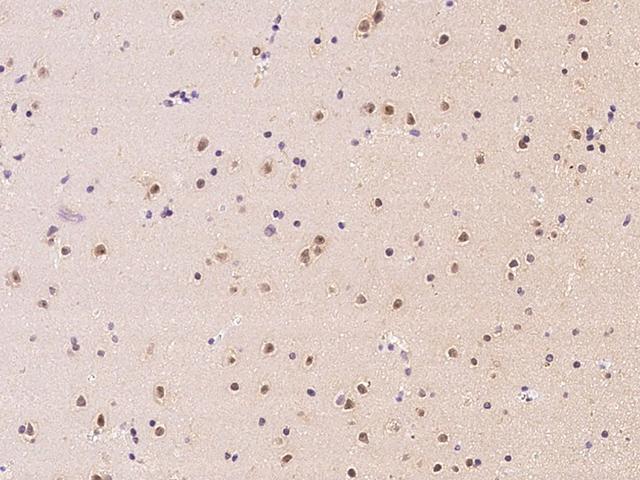 Aprataxin / APTX Antibody - Immunochemical staining of human APTX in human brain with rabbit polyclonal antibody at 1:100 dilution, formalin-fixed paraffin embedded sections.