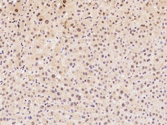 Aprataxin / APTX Antibody - Immunochemical staining of human APTX in human liver with rabbit polyclonal antibody at 1:100 dilution, formalin-fixed paraffin embedded sections.