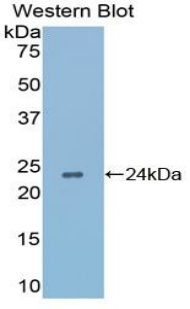 APRT Antibody - Western blot of recombinant APRT.  This image was taken for the unconjugated form of this product. Other forms have not been tested.