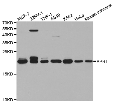 APRT Antibody - Western blot analysis of extracts of various cell lines.