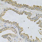APRT Antibody - Immunohistochemistry of paraffin-embedded human prostate using APRT Antibody at dilution of 1:100 (40x lens).