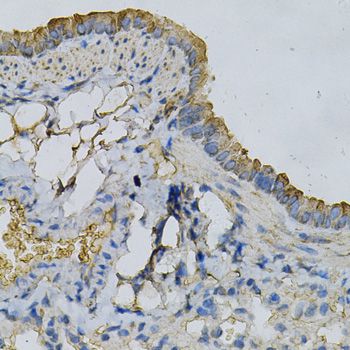 APRT Antibody - Immunohistochemistry of paraffin-embedded mouse lung using APRT Antibody at dilution of 1:100 (40x lens).