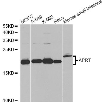 APRT Antibody - Western blot analysis of extracts of various cell lines, using APRT antibody at 1:1000 dilution. The secondary antibody used was an HRP Goat Anti-Rabbit IgG (H+L) at 1:10000 dilution. Lysates were loaded 25ug per lane and 3% nonfat dry milk in TBST was used for blocking. An ECL Kit was used for detection and the exposure time was 10s.