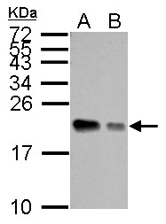 APRT Antibody - APRT antibody detects APRT protein by Western blot analysis. A. 30 ug 293T whole cell lysate/extract. B. 30 ug A431 whole cell lysate/extract. 15 % SDS-PAGE. APRT antibody dilution:1:1000