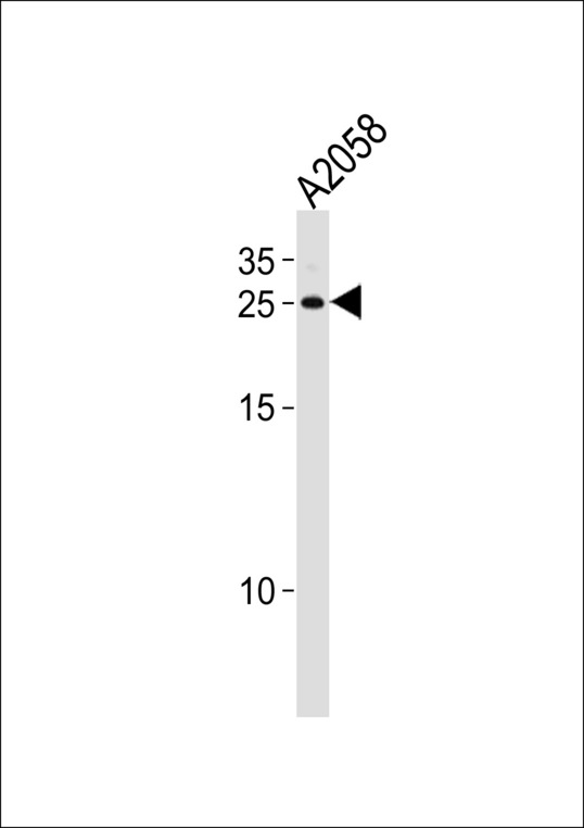 APRT Antibody - APRT Antibody western blot of A2058 cell line lysates (35 ug/lane). The APRT antibody detected the APRT protein (arrow).