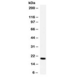 APRT Antibody - Western blot testing of human K562 cell lysate with APRT antibody at 0.5ug/ml. Predicted molecular weight ~20 kDa.