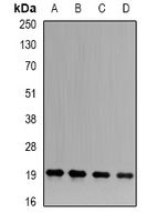 APRT Antibody - Western blot analysis of APRT expression in THP1 (A); A549 (B); K562 (C); mouse intestine (D) whole cell lysates.