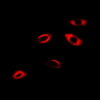 APRT Antibody - Immunofluorescent analysis of APRT staining in A549 cells. Formalin-fixed cells were permeabilized with 0.1% Triton X-100 in TBS for 5-10 minutes and blocked with 3% BSA-PBS for 30 minutes at room temperature. Cells were probed with the primary antibody in 3% BSA-PBS and incubated overnight at 4 deg C in a humidified chamber. Cells were washed with PBST and incubated with a DyLight 594-conjugated secondary antibody (red) in PBS at room temperature in the dark.