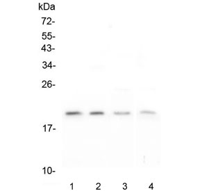 APRT Antibody - Western blot testing of human 1) T-47D, 2) HEK293, 3) K562 and 4) Caco-2 lysate with APRT antibody at 0.5ug/ml. Predicted molecular weight ~20 kDa.