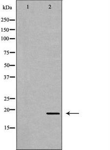 APRT Antibody - Western blot analysis of HeLa whole cells lysates using APRT antibody. The lane on the left is treated with the antigen-specific peptide.