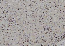 APRT Antibody - 1:100 staining human liver tissue by IHC-P. The sample was formaldehyde fixed and a heat mediated antigen retrieval step in citrate buffer was performed. The sample was then blocked and incubated with the antibody for 1.5 hours at 22°C. An HRP conjugated goat anti-rabbit antibody was used as the secondary.