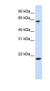 APRT Antibody - APRT antibody Western blot of 293T cell lysate.  This image was taken for the unconjugated form of this product. Other forms have not been tested.