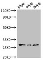 APX2 Antibody - Western Blot Positive WB detected in: Arabidopsis thaliana lysate at 80µg, 40µg, 20µg All lanes: APX2 antibody at 0.6µg/ml Secondary Goat polyclonal to rabbit IgG at 1/50000 dilution Predicted band size: 29 kDa Observed band size: 29 kDa