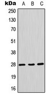 AQP1 / Aquaporin 1 Antibody - Western blot analysis of Aquaporin 1 expression in A549 (A); mouse liver (B); rat liver (C) whole cell lysates.