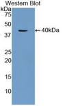 AQP1 / Aquaporin 1 Antibody - Western blot of recombinant AQP1 / Aquaporin 1.  This image was taken for the unconjugated form of this product. Other forms have not been tested.