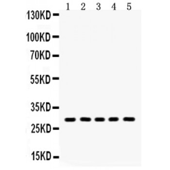 AQP1 / Aquaporin 1 Antibody - Aquaporin 1 antibody Western blot. All lanes: Anti Aquaporin 1 at 0.5 ug/ml. Lane 1: Rat Kidney Tissue Lysate at 50 ug. Lane 2: Rat Lung Tissue Lysate at 50 ug. Lane 3: Rat Cardiac Muscle Tissue Lysate at 50 ug. Lane 4: PC-12 Whole Cell Lysate at 40 ug. Lane 5: HEPA Whole Cell Lysate at 40 ug. Predicted band size: 29 kD. Observed band size: 29 kD.