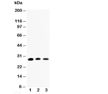 AQP1 / Aquaporin 1 Antibody - Western blot testing of AQP1 antibody and Lane 1: rat kidney; 2: rat lung; 3: SMMC-7721 cell lysate