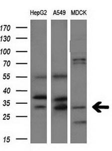 AQP1 / Aquaporin 1 Antibody - Western blot of extracts (10ug) from 3 different cell lines by using anti-AQP1 monoclonal antibody at 1:200 dilution.