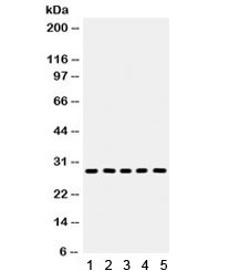 AQP1 / Aquaporin 1 Antibody