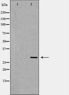AQP1 / Aquaporin 1 Antibody - Western blot analysis of AQP1 expression in rat brain. The lane on the left is treated with the antigen-specific peptide.