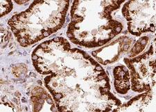 AQP1 / Aquaporin 1 Antibody - 1:100 staining human kidney tissue by IHC-P. The tissue was formaldehyde fixed and a heat mediated antigen retrieval step in citrate buffer was performed. The tissue was then blocked and incubated with the antibody for 1.5 hours at 22°C. An HRP conjugated goat anti-rabbit antibody was used as the secondary.