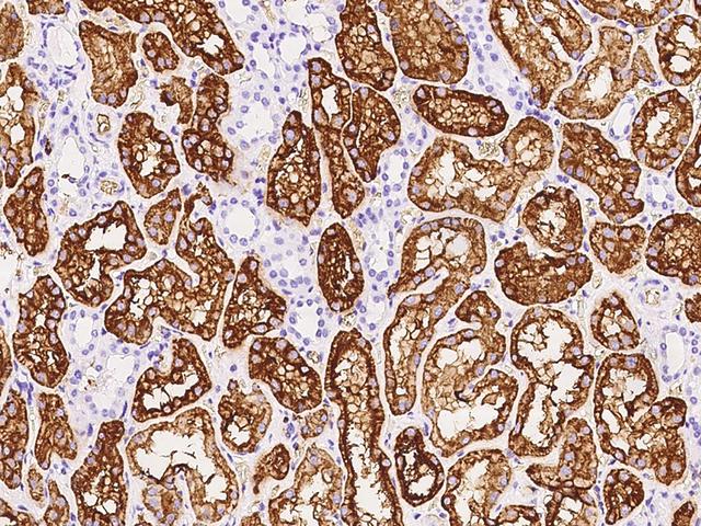 AQP1 / Aquaporin 1 Antibody - Immunochemical staining of human AQP1 in human kidney with rabbit polyclonal antibody at 1:500 dilution, formalin-fixed paraffin embedded sections.