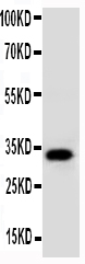 AQP10 / Aquaporin 10 Antibody - WB of AQP10 / Aquaporin 10 antibody. All lanes: Anti-AQP10 at 0.5ug/ml. WB: COLO320 Whole Cell Lysate at 40ug. Predicted bind size: 32KD. Observed bind size: 32KD.
