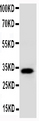 AQP10 / Aquaporin 10 Antibody - WB of AQP10 / Aquaporin 10 antibody. All lanes: Anti-AQP10 at 0.5ug/ml. WB: COLO320 Whole Cell Lysate at 40ug. Predicted bind size: 32KD. Observed bind size: 32KD.