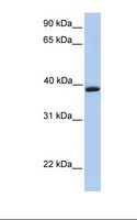 AQP10 / Aquaporin 10 Antibody - Jurkat cell lysate. Antibody concentration: 1.0 ug/ml. Gel concentration: 12%.  This image was taken for the unconjugated form of this product. Other forms have not been tested.