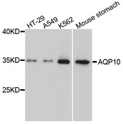 AQP10 / Aquaporin 10 Antibody - Western blot analysis of extracts of various cells.