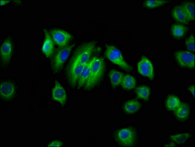 AQP10 / Aquaporin 10 Antibody - Immunofluorescence staining of A549 cells at a dilution of 1:66, counter-stained with DAPI. The cells were fixed in 4% formaldehyde, permeabilized using 0.2% Triton X-100 and blocked in 10% normal Goat Serum. The cells were then incubated with the antibody overnight at 4 °C.The secondary antibody was Alexa Fluor 488-congugated AffiniPure Goat Anti-Rabbit IgG (H+L) .