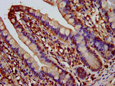 AQP10 / Aquaporin 10 Antibody - IHC image of AQP10 Antibody diluted at 1:200 and staining in paraffin-embedded human small intestine tissue performed on a Leica BondTM system. After dewaxing and hydration, antigen retrieval was mediated by high pressure in a citrate buffer (pH 6.0). Section was blocked with 10% normal goat serum 30min at RT. Then primary antibody (1% BSA) was incubated at 4°C overnight. The primary is detected by a biotinylated secondary antibody and visualized using an HRP conjugated SP system.