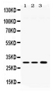 AQP11 / Aquaporin 11 Antibody - Western blot - Anti-AQP11/Aquaporin 11 Picoband Antibody