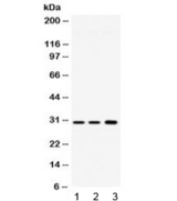 AQP11 / Aquaporin 11 Antibody - Western blot testing of 1) rat brain, 2) mouse brain and 3) human HeLa lysate with AQP11 antibody at 0.5ug/ml. Predicted molecular weight ~30 kDa.