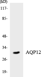 AQP12A / Aquaporin 12A Antibody - Western blot analysis of the lysates from HUVECcells using AQP12 antibody.