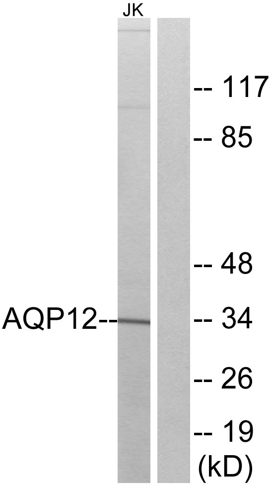 AQP12A / Aquaporin 12A Antibody - Western blot analysis of lysates from Jurkat cells, using AQP12 Antibody. The lane on the right is blocked with the synthesized peptide.