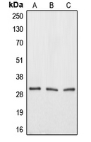 AQP12A / Aquaporin 12A Antibody - Western blot analysis of Aquaporin 12A expression in HEK293T (A); mouse testis (B); rat kidney (C) whole cell lysates.