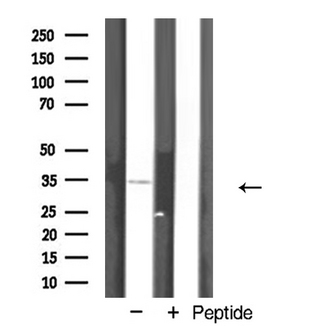 AQP12A / Aquaporin 12A Antibody - Western blot analysis of AQP12 expression in Jurkat cells